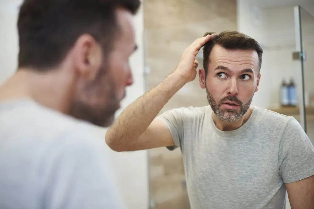 Male Baldness Solutions