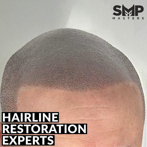 Scalp pigmentation