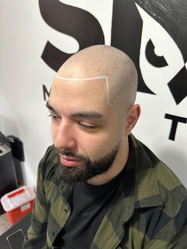 Brooklyn Scalp Micropigmentation