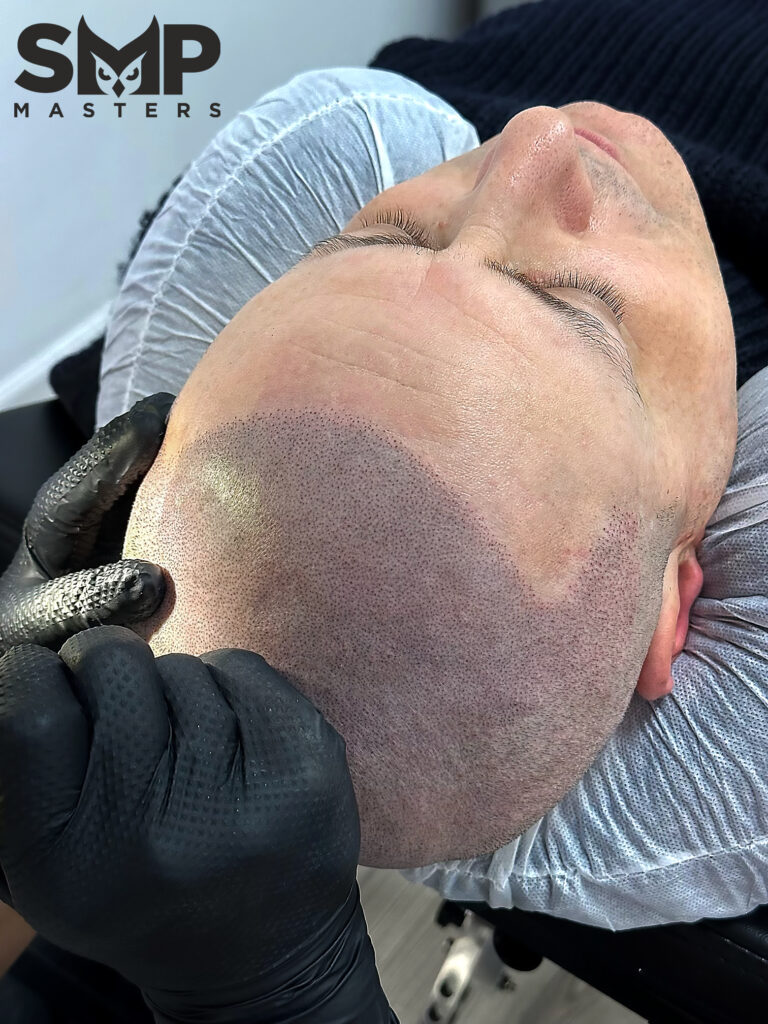 Hair Loss Tattoo Solutions