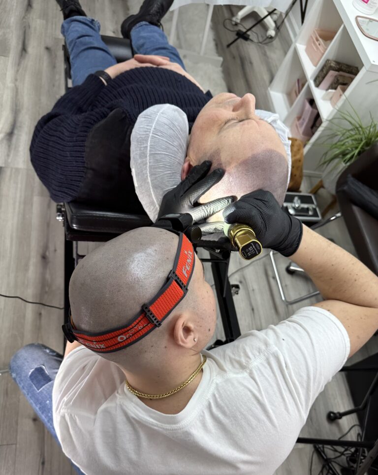 Scalp Micropigmentation LI