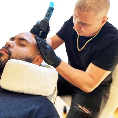 Scalp Micropigmentation in Staten Island